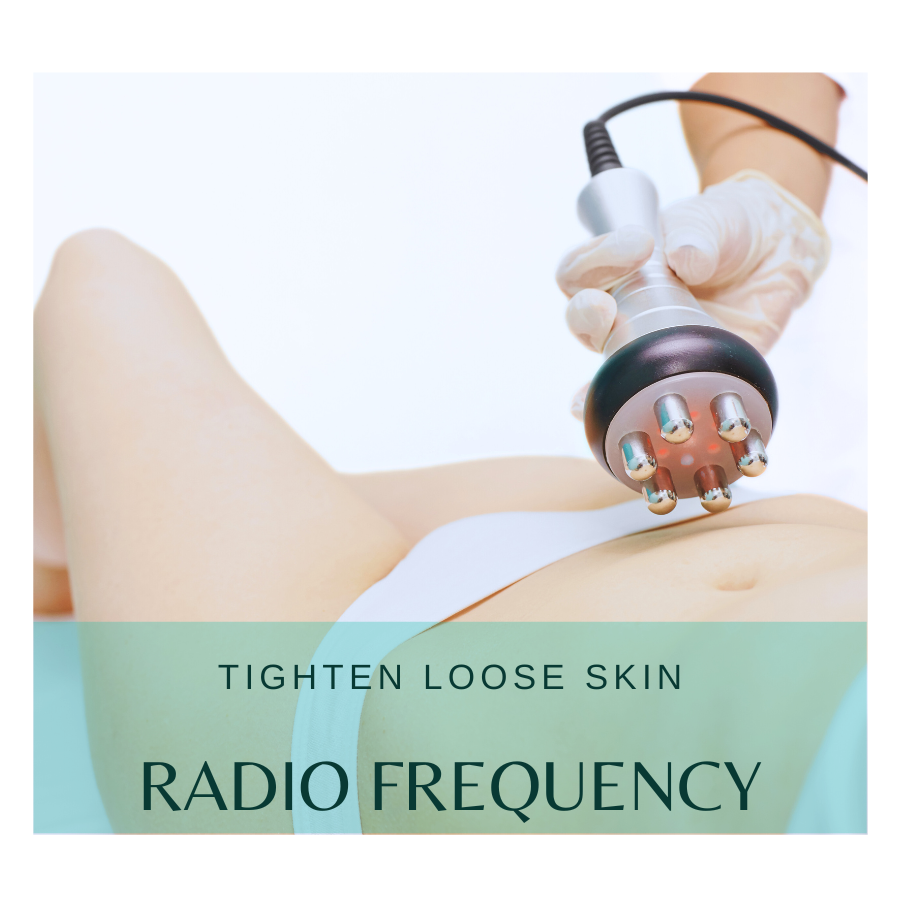 Radio Frequency Body